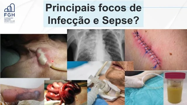 VÃ­deo Treinamento SEPSE